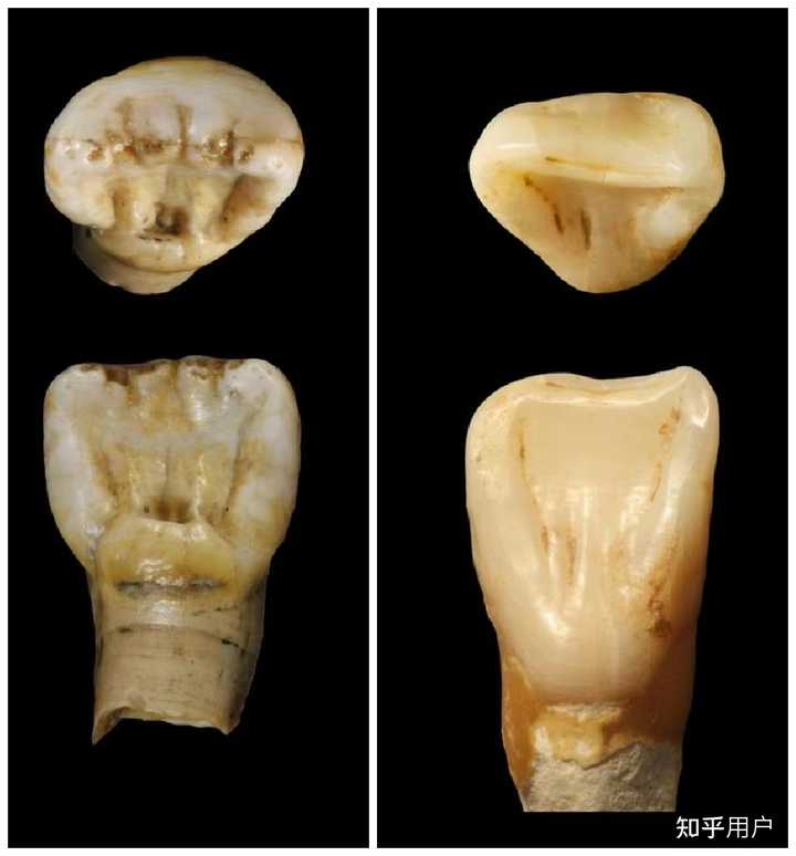 是不是中国人多数都有和直立人一样的铲型门齿？为什么？ - 知乎