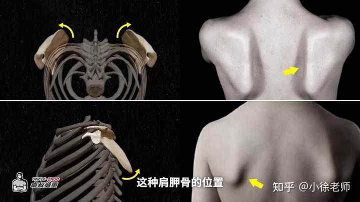 为什么有些人背部脊柱沟凹进去很深，而有的人凸出来很明显？ - 知乎
