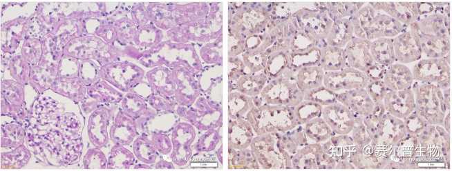 免疫组化实验操作要点有哪些？ - 知乎