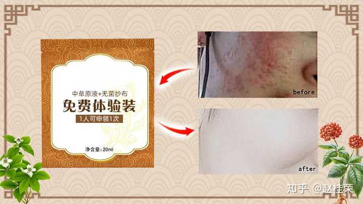 脸上过敏性皮炎反反复复，平常生活中应该注意什么?_? - 知乎