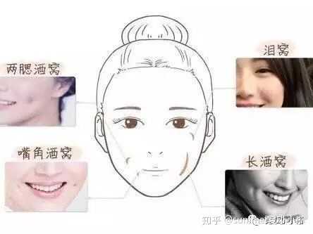 酒窝可以后天形成吗? - 知乎