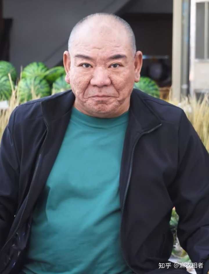 橘子皮脸的人真的人品不行么? - 知乎