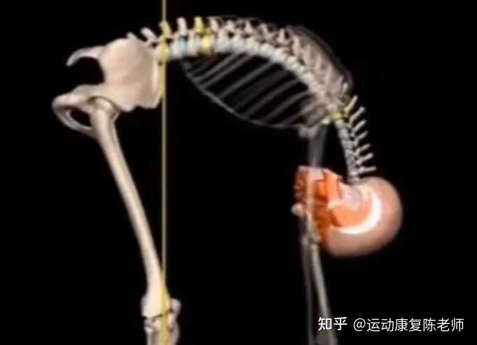 突然背挺直就痛,驼背就不痛是什么情况? - 知乎