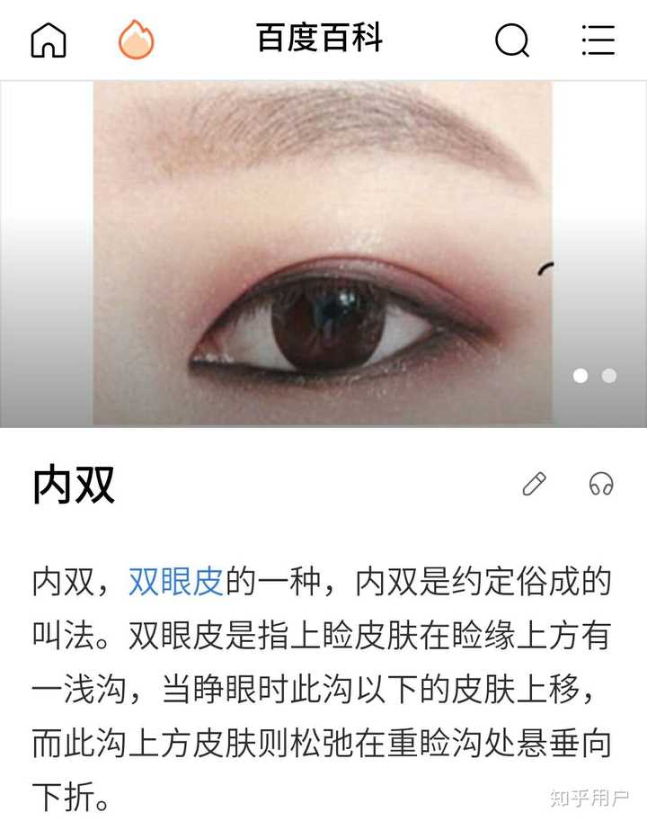 内双和外双的区别是什么?因为有人告诉我,双眼皮的褶皱和眼角有交点就是内双,无论你的双眼皮多宽? - 知乎