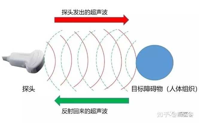 A超、B超、M超和多普勒彩超的原理和不同之处? - 知乎