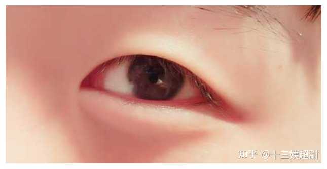内双到底是那样的,和双眼皮以及单眼皮有什么大的区别? - 知乎