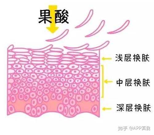 痘印心得经验_痘印心得经验_痘印心得经验