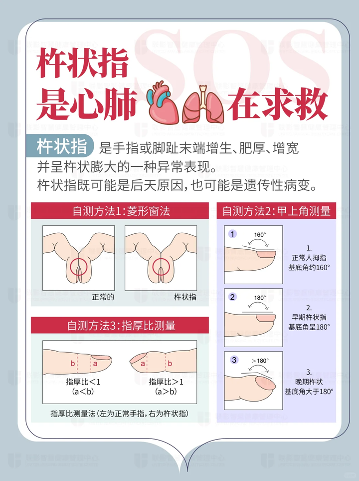 手指头变圆变鼓,是杵状指吗? - 知乎