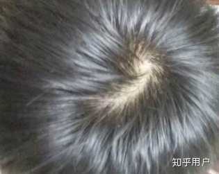 头发上的漩涡可以弄掉吗？ - 知乎