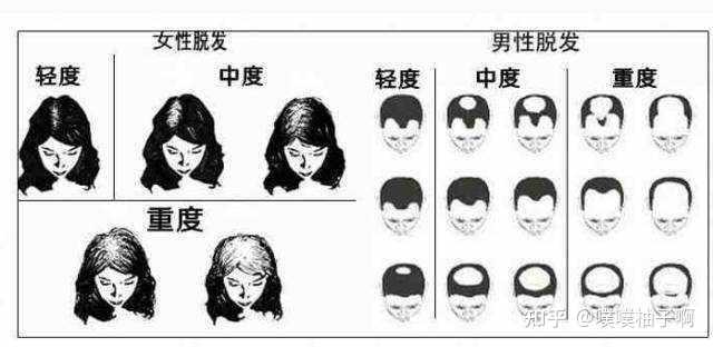 这样的发缝宽度算正常吗? - 知乎