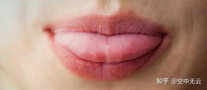 想请问,一直吐大舌头的是什么病,是那种不自觉的吐舌头? - 知乎