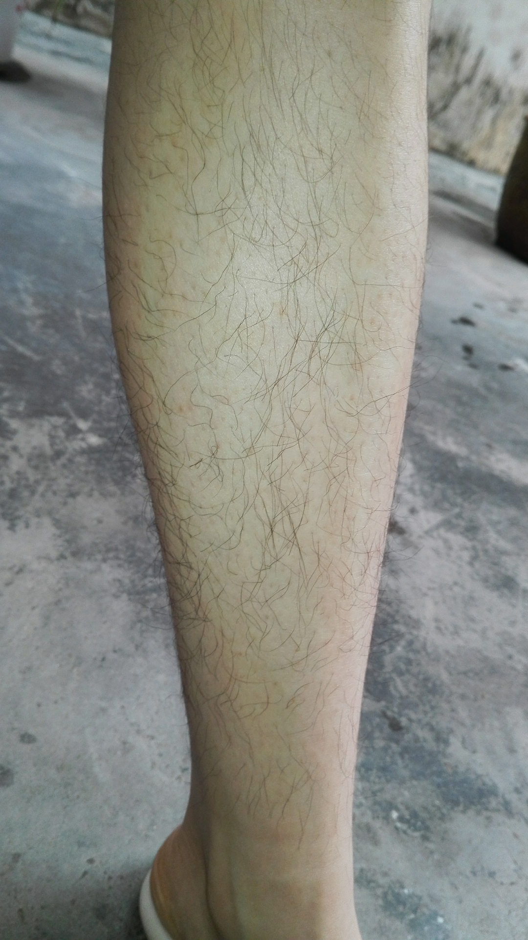 女生腿毛旺盛是怎样的人生体验