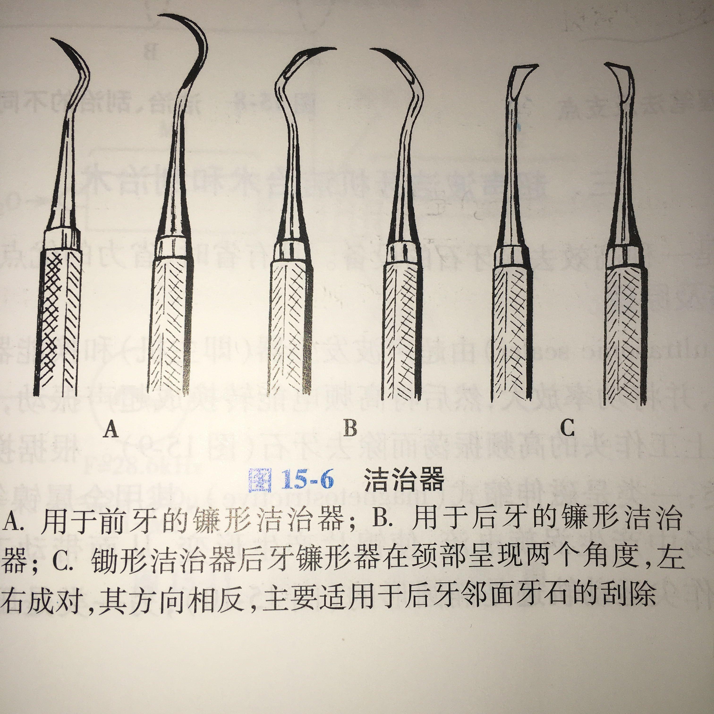 镰形洁治器使用图示图片