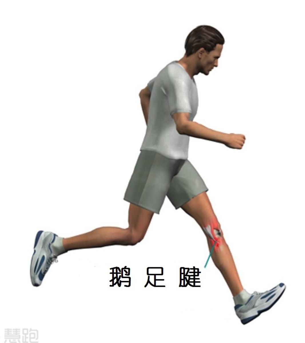 为什么运动后膝盖内侧酸痛?
