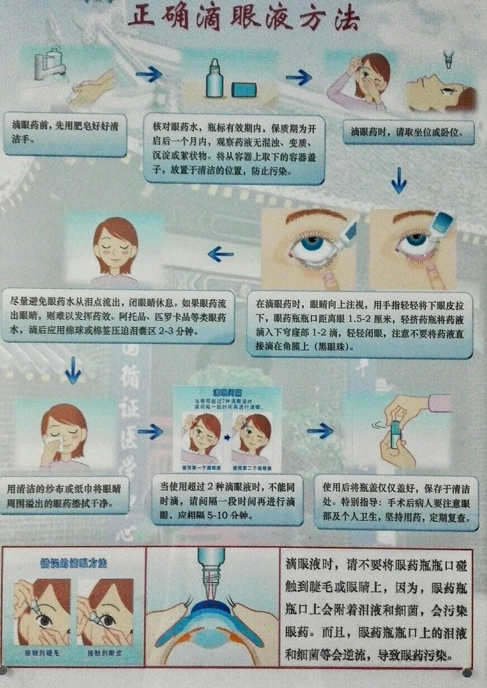 最正确的滴眼药水操作步骤是怎样的? - 知乎