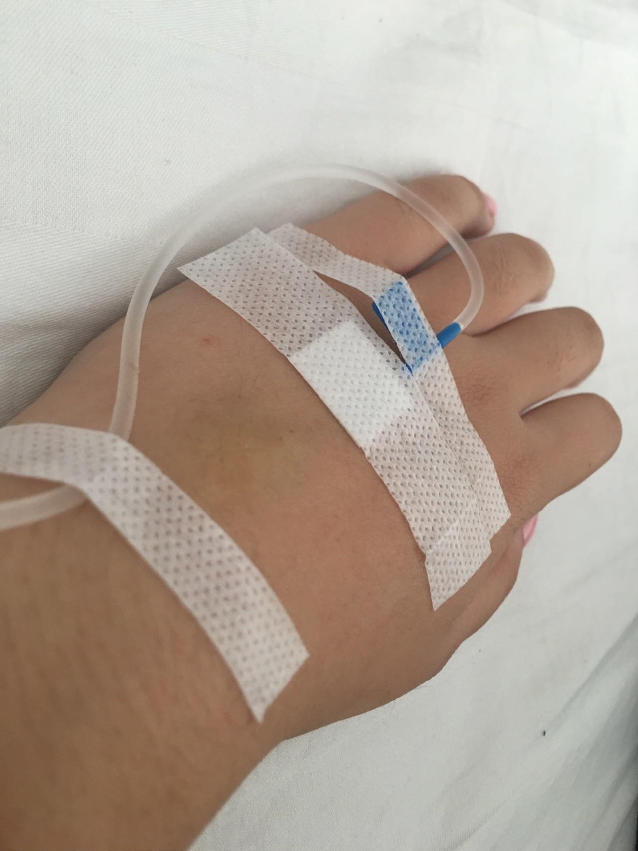 为什么静脉注射阿奇霉素对血管刺激这么严重? - 知乎