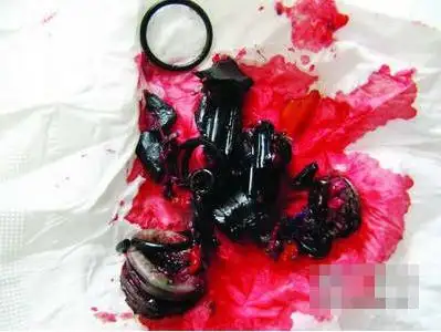 升降椅爆炸瞬间的威力有多大为什么新闻看到的照片那么恐怖