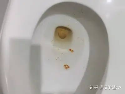 哪一种减肥药的效果比较好有人吃过奥利司他吗