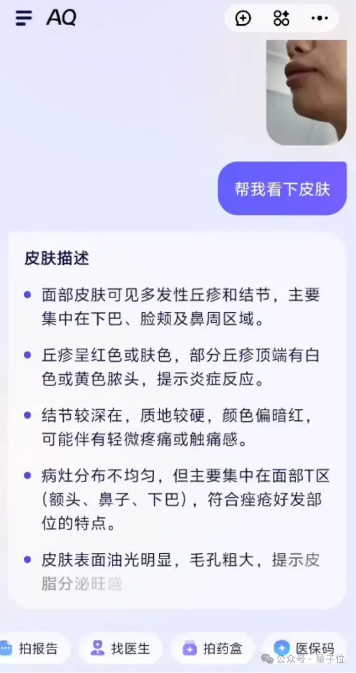 真·全民AI健康管家来了！实测蚂蚁AQ：追问识药看皮肤，还能连医院接硬件