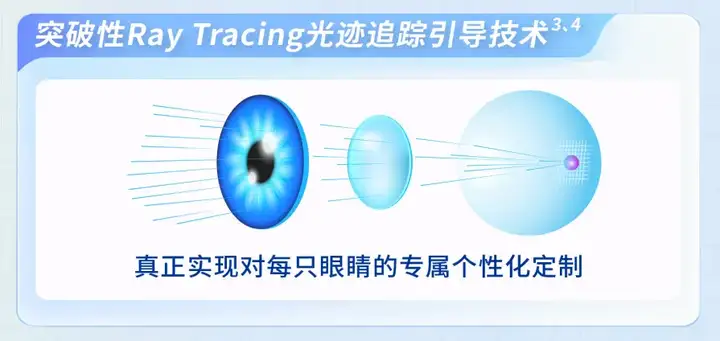 尖峰眼科：个性化摘镜方案再升级，近视手术“黑科技”全光塑是什么？