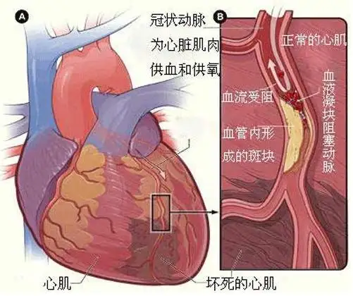 冬柠是彰肌梗榄？(图1)