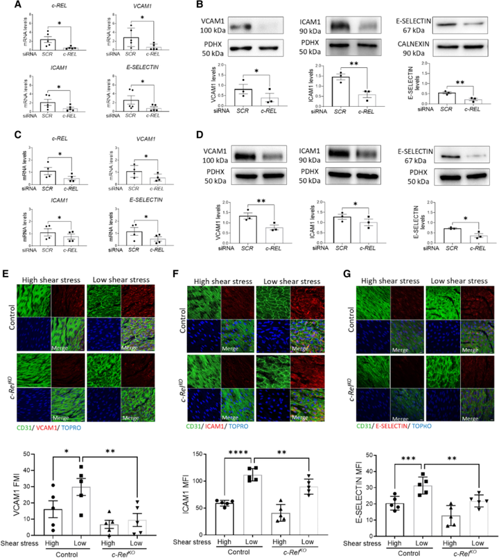 內皮 c-REL 通過與 TXNIP-p38 和非經典 NF-κB 通路的串擾在血流紊亂區域協調動脈粥樣硬化