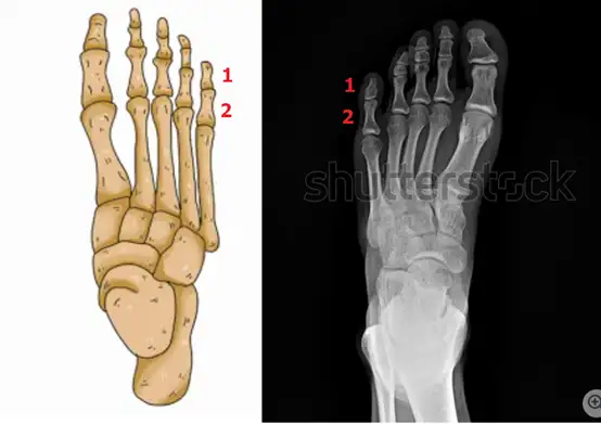 现在的人类肯定还在进化，但是有什么迹象能表明吗？