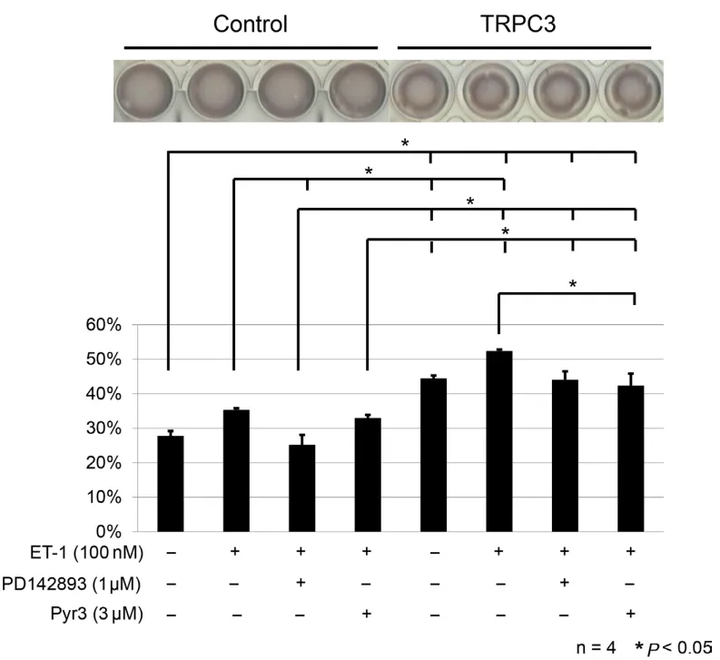拉伸通過增強成纖維細胞中內皮素受體B和TRPC3 的表達來促進傷口收縮