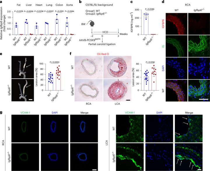 内皮胰岛素样生长因子结合蛋白6(IGFBP6)抑制血管炎症和动脉粥样硬化 内皮胰岛素样生长因子结合蛋白6(IGFBP6)抑制血管炎症和动脉粥样硬化