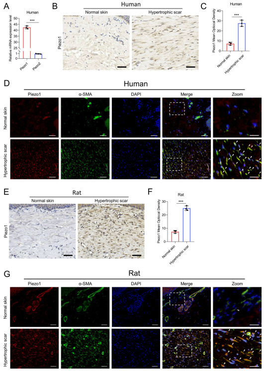 機(jī)械牽張通過機(jī)械激活的陽離子通道 Piezo1 促進(jìn)增生性瘢痕的形成