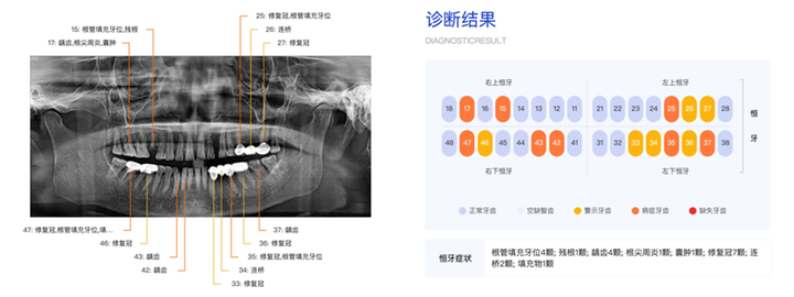 引领口腔行业数字化升级,睿知影口腔智能影像服务,重磅上线