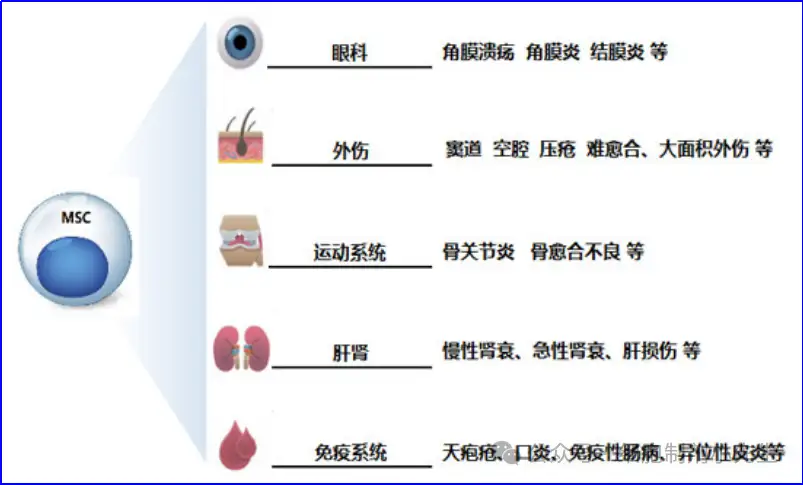 v2-214cf584c8b7f124039b7c74b337c07f_1440w.webp