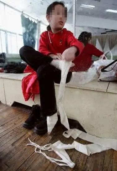 现在还有人或者家长因为脚大不好看而让孩子裹脚的吗? - 知乎