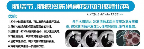 成都中医哮喘医院——芮军：冷冻消融技术为肺结节患者治疗带来新希望