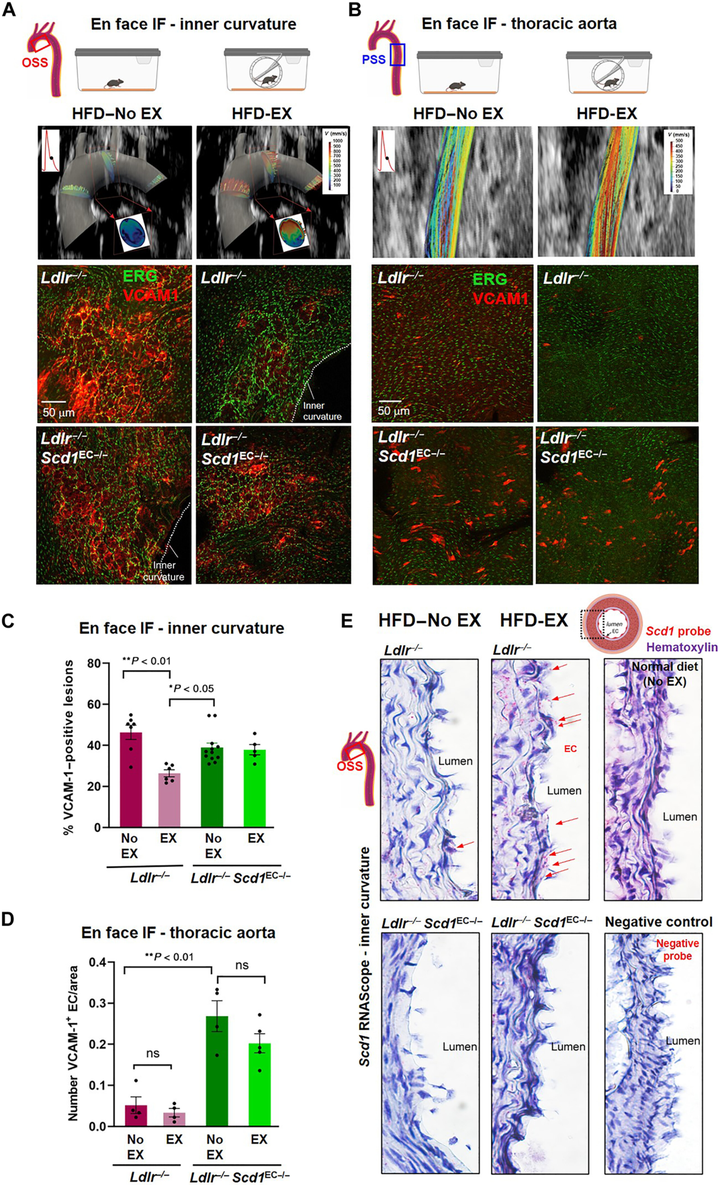 運(yùn)動(dòng)可減輕血流再循環(huán)并激活代謝轉(zhuǎn)能器 SCD1 以催化血管保護(hù)性代謝物
