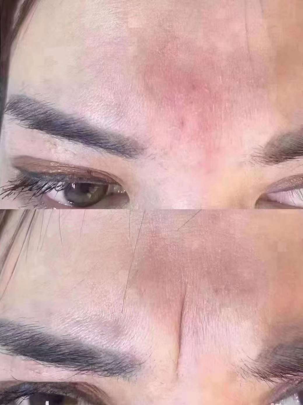 杭州美莱小来 的想法: 川字纹:斩子剑,风水学讲说挡子女运势