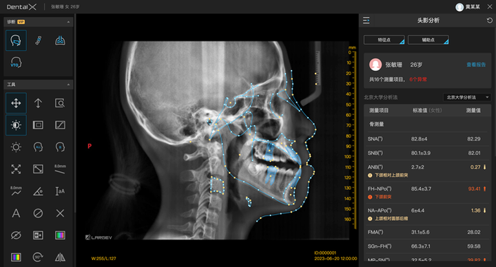 引领口腔行业数字化升级,睿知影口腔智能影像服务,重磅上线