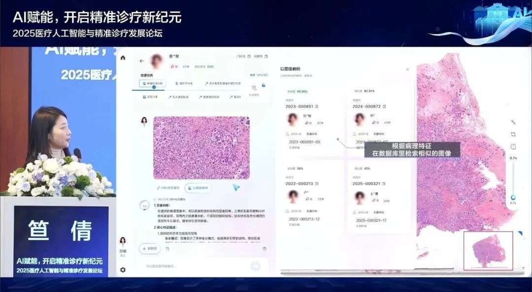 重磅！华为联手顶级三甲，AI医疗大模型开源！