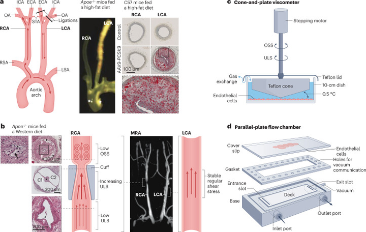 動脈粥樣硬化中血流誘導的內皮細胞重編程 動脈粥樣硬化中血流誘導的內皮細胞重編程