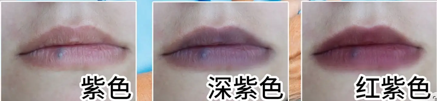 为什么有人说嘴唇发紫就是心脏不好，这是真的吗？人的面容和身体器官的病变有联系吗？