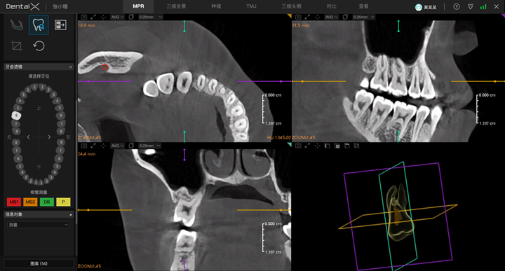 引领口腔行业数字化升级,睿知影口腔智能影像服务,重磅上线