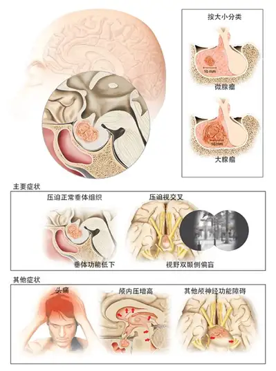 儿童脑垂体大小对照表图片