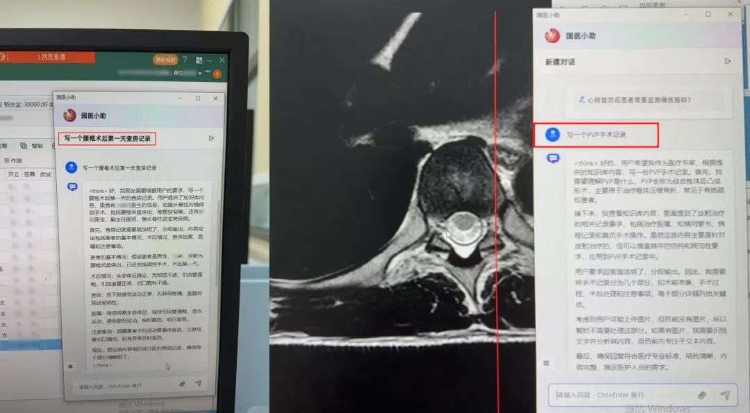 热议！AI误诊，上海患者获赔127万？医疗AI的“锅”谁来背?