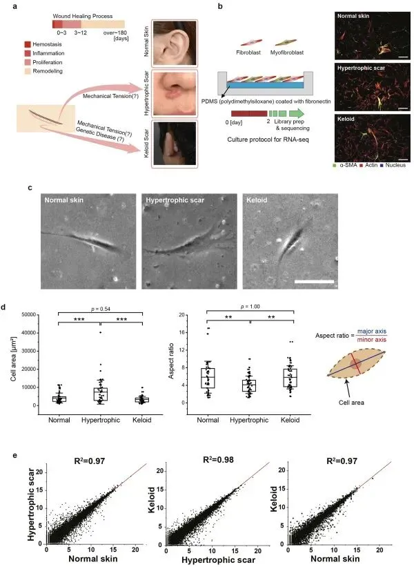 成纖維細(xì)胞中張力敏感的 HOX 基因表達(dá)用于差異瘢痕形成