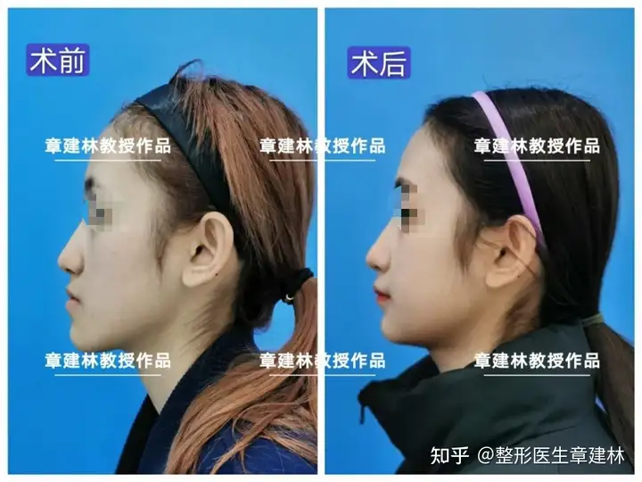为什么脸部看上去十分扁平? - 知乎