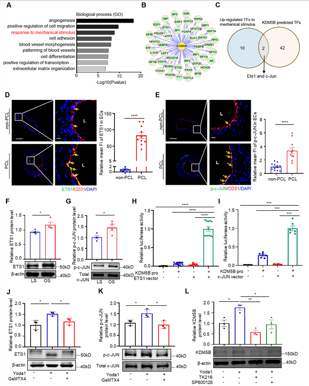 Piezo1 調(diào)控的內(nèi)皮 KDM5B 參與紊亂血流誘導(dǎo)的動(dòng)脈粥樣硬化斑塊形成