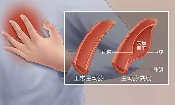 在救命这件事上，AI开始做医生做不到的事了。