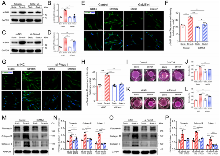 機(jī)械牽張通過機(jī)械激活的陽離子通道 Piezo1 促進(jìn)增生性瘢痕的形成
