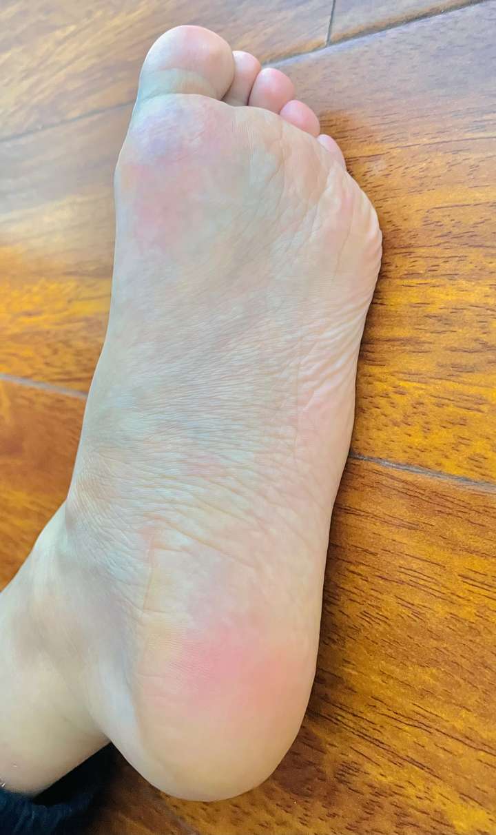 男孩子的脚底很嫩怎么样?