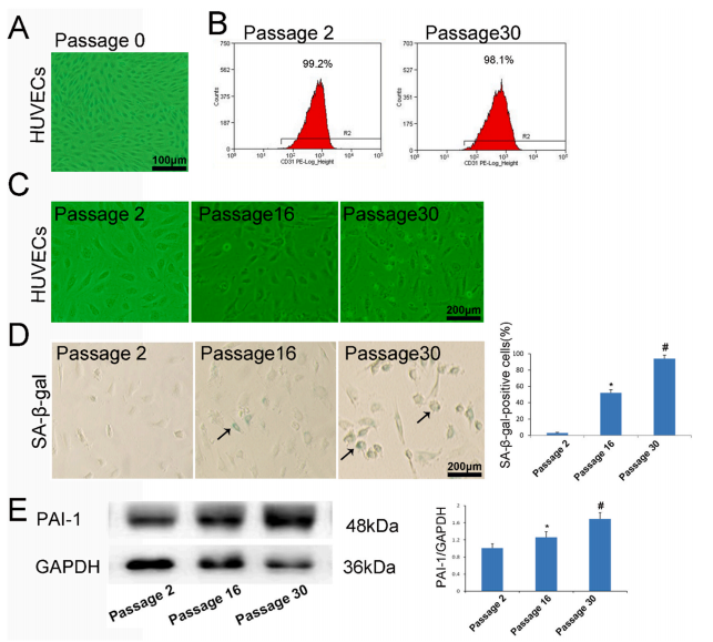人参皂苷 Rb1通过调控 SIRT1/caveolin-1/eNOS 信号通路来预防年龄相关的血管内皮细胞衰老 人参皂苷 Rb1通过调控 SIRT1/caveolin-1/eNOS 信号通路来预防年龄相关的血管内皮细胞衰老